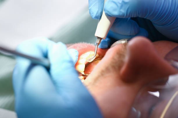 Best Emergency Dental Care for Sports Injuries in Pond Creek, OK