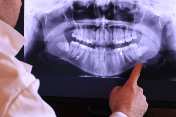 Best Urgent Dental Care for Toothaches in Pond Creek, OK