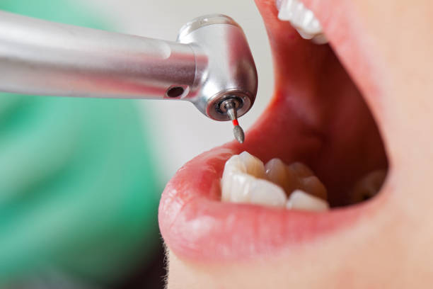 Best Emergency Denture Repair in Pond Creek, OK